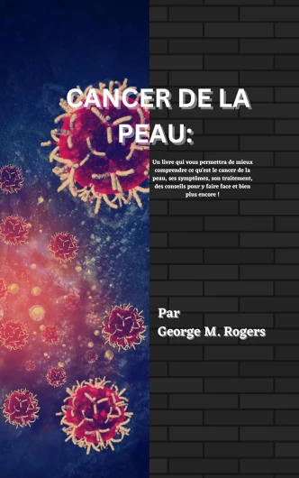CANCER DE LA PEAU: Un livre qui vous permettra de mieux comprendre ce qu'est le cancer de la peau, ses symptômes, son traitement, des conseils pour y faire face et bien plus encore !