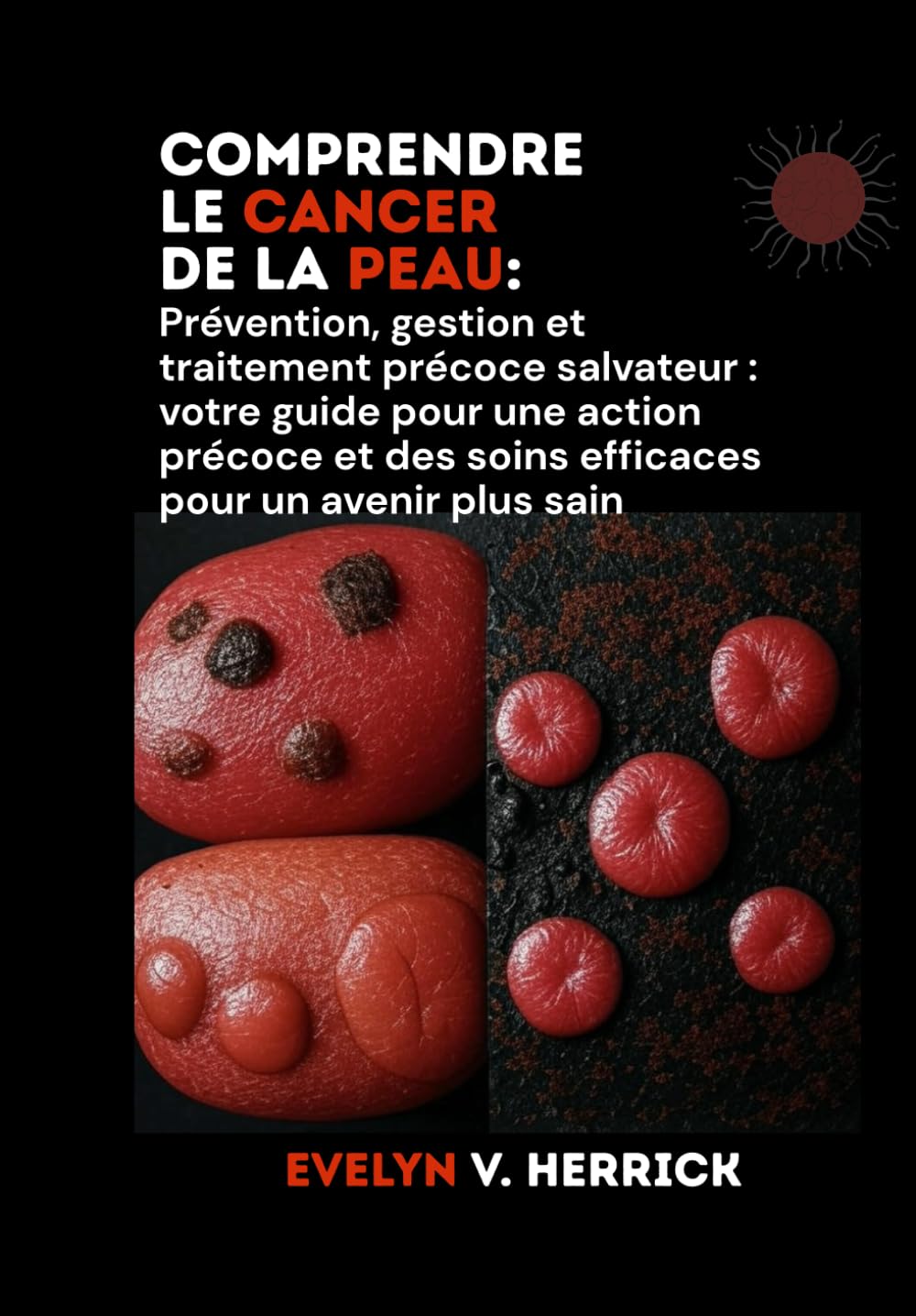 Comprendre le cancer de la peau: Prévention, gestion et traitement précoce salvateur : votre guide pour une action précoce et des soins efficaces pour un avenir plus sain