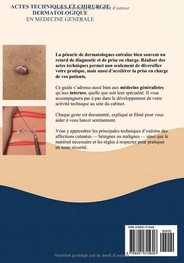 Actes techniques et chirurgie dermatologique en médecine générale