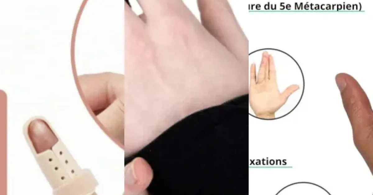 Classement des 5 meilleurs attelles doigt (juin 2026)