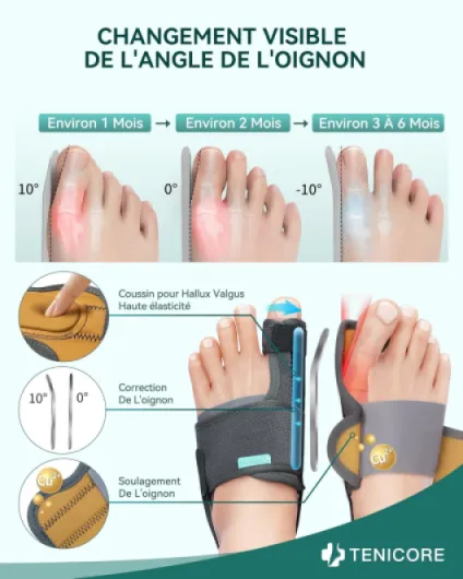 Amélioré Hallux Valgus Correcteur avec 2 Barres d'angle，Orthese Hallux Valgus avec Coussin en Silicone Soulagement des Hallux Valgus Séparateurs d'orteils 1 Paire Femme et Homme