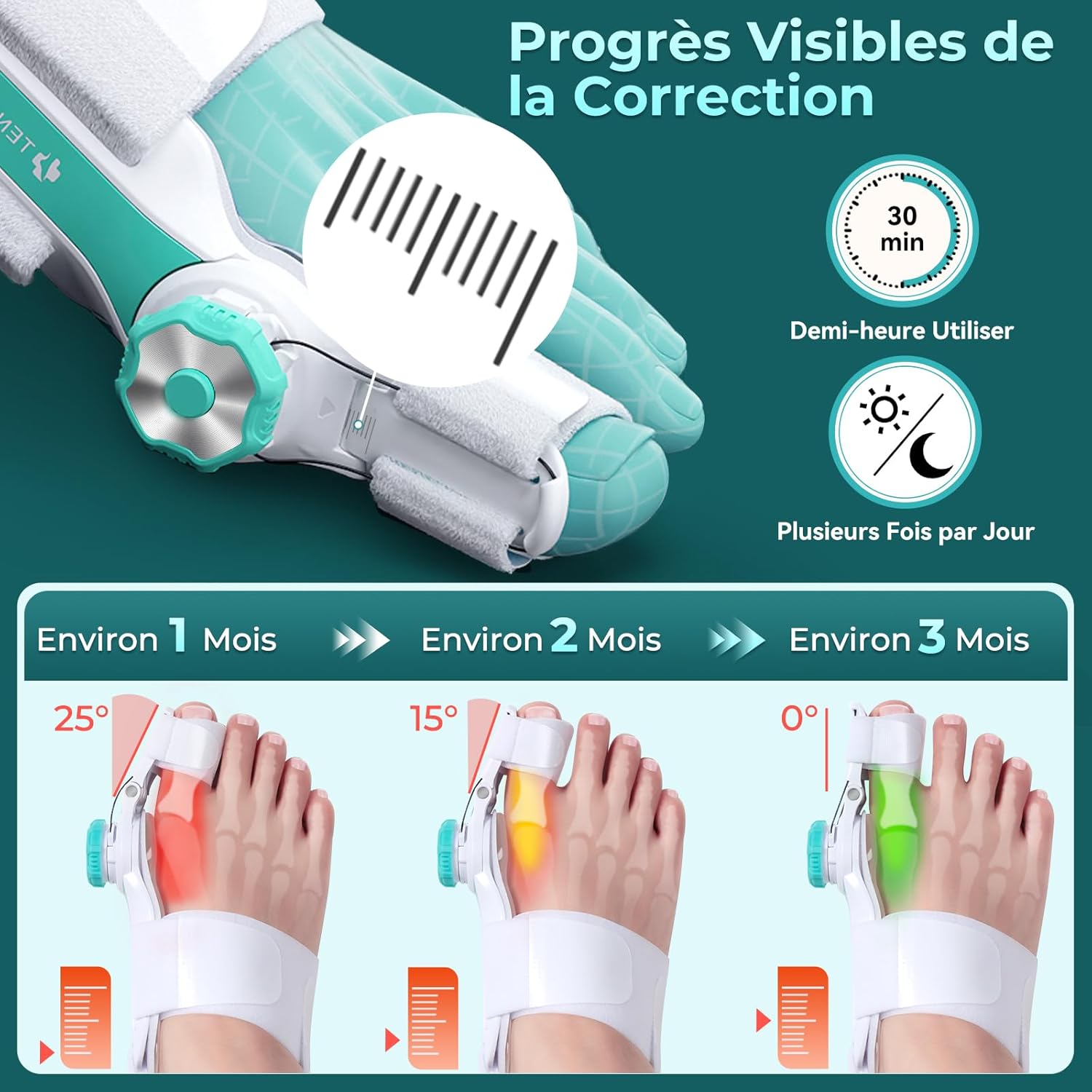 Orthese Hallux Valgus Boutons Réglables Separateur D'orteil Attelle pour Hallux Valgus Homme et Femme Pour Redresser les Orteils 1 Pièce Taille M M 1